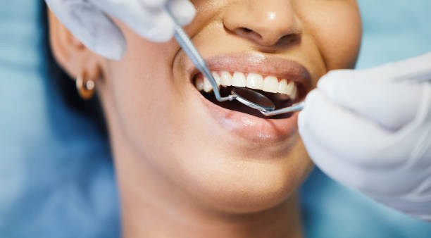 Best Emergency Dentist for Lost Fillings or Crowns in Valley View, PA