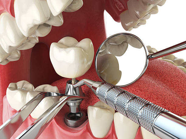 Best Broken or Cracked Tooth Emergency Dentist in Valley View, PA